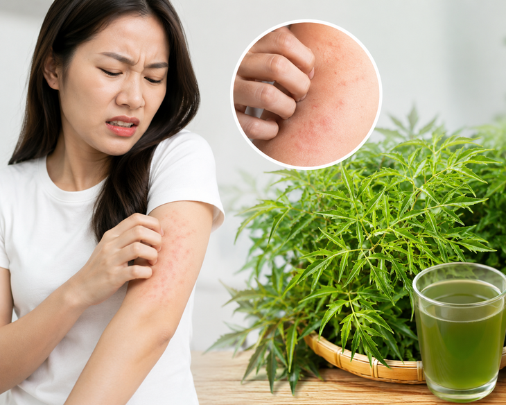 Lá đinh lăng có tác dụng thanh nhiệt, giải độc, chữa ngứa da, nổi mề đay... Ảnh AI