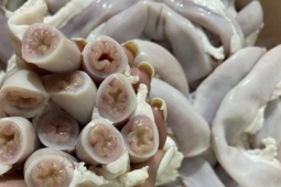 'Lòng se điếu' hình thành từ ruột non nhiễm giun sán, nhiễm độc