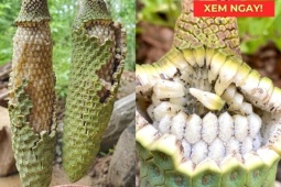 Tin tức sức khỏe - Mách nhỏ quý ông nào bị tiểu đêm nhiều lần, tiểu khó nên làm việc này ngay lập tức