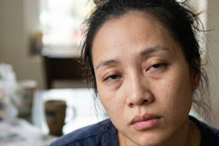 7 sai lầm trong chăm sóc da khiến da xỉn màu và mệt mỏi