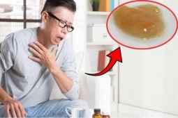 Tin tức sức khỏe - Đừng đợi đờm chuyển vàng xanh mới chú ý: 3 dấu hiệu này còn đáng lo hơn
