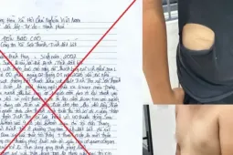 Tự rạch bụng, xé áo dựng hiện trường giả bị cướp