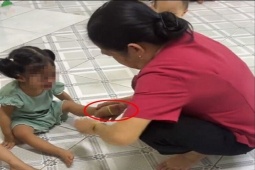 Xác minh làm rõ video bảo mẫu đánh, bắn dây thun vào chân trẻ mầm non ở TP.HCM