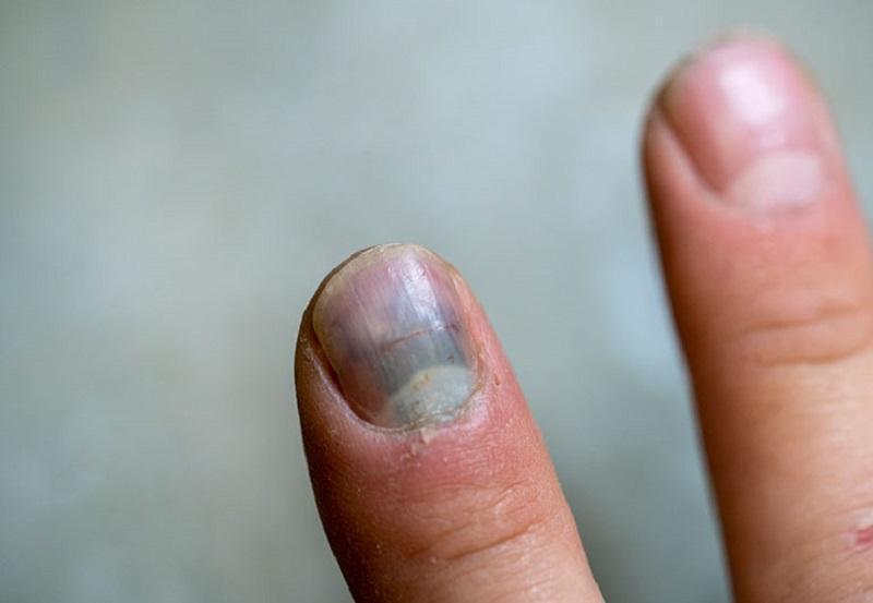 5 dấu hiệu báo động phổi đang "xuống cấp" rất nhanh: Nhiều người hối hận vì biết quá muộn! - 3