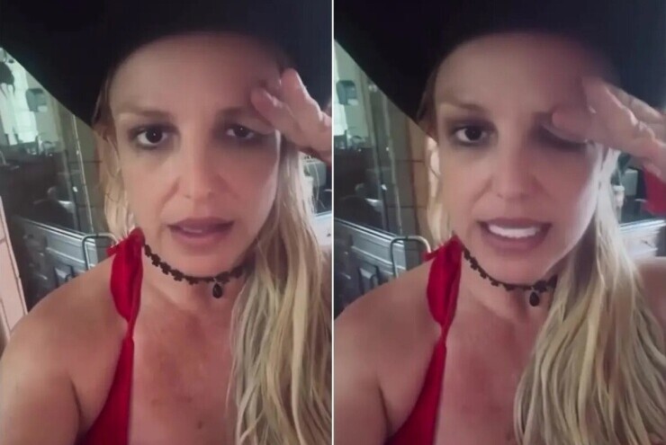 Britney Spears bị sụp mí mắt vì tiêm botox