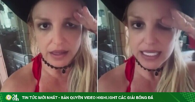 Britney Spears bị sụp mí mắt vì tiêm botox