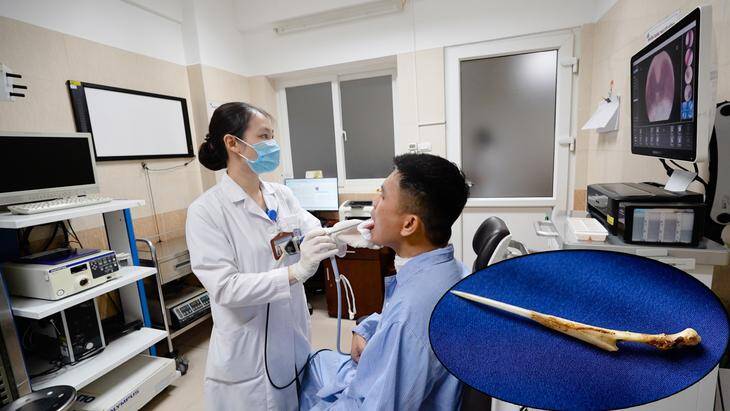Các sĩ tiến hành nội soi tìm dị vật ở bệnh nhân. Ảnh: BVCC