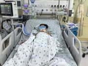 Ăn thịt chuột, ba chị em nguy kịch do ngộ độc