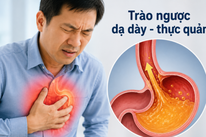 Đau ngực tưởng mắc bệnh tim, bác sĩ phát hiện 'thủ phạm' từ dạ dày