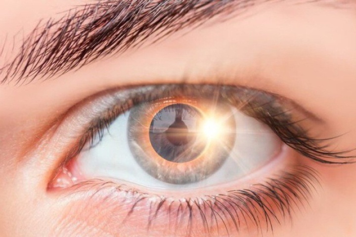 Cô gái suốt đời thấy hình lưỡi liềm trong mắt chỉ sau vài giây xem nhật thực