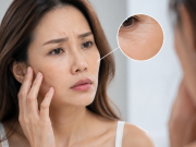 6 dấu hiệu làn da đang già đi nhanh hơn tuổi thật