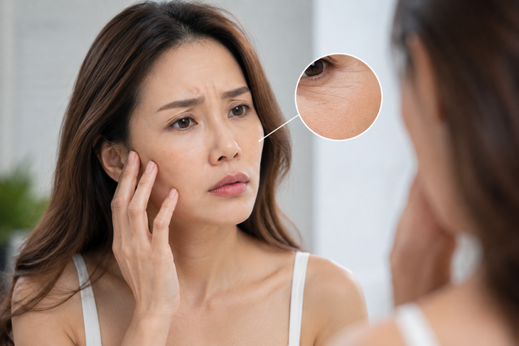 Sự xuất hiện ngày càng nhiều của đốm nâu, vùng tăng sắc tố hoặc màu da không đồng đều là một biểu hiện thường gặp của da bị lão hóa. Ảnh minh họa AI.
