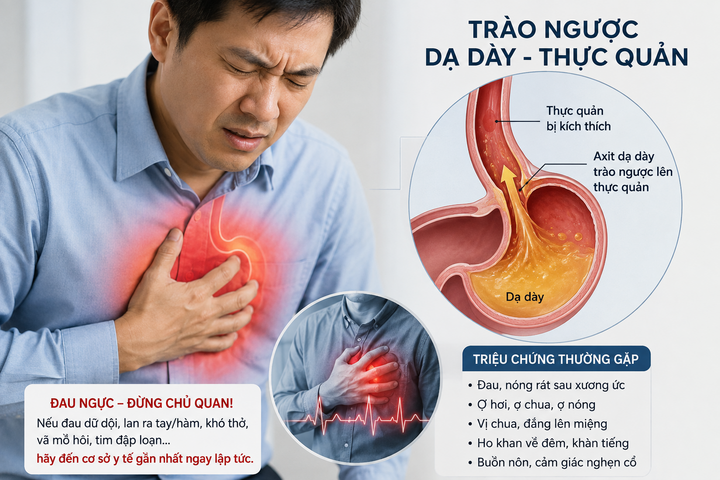 Đau ngực tưởng mắc bệnh tim, bác sĩ phát hiện ‘thủ phạm’ từ dạ dày. (Ảnh minh họa)