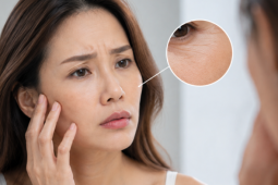 6 dấu hiệu làn da đang già đi nhanh hơn tuổi thật