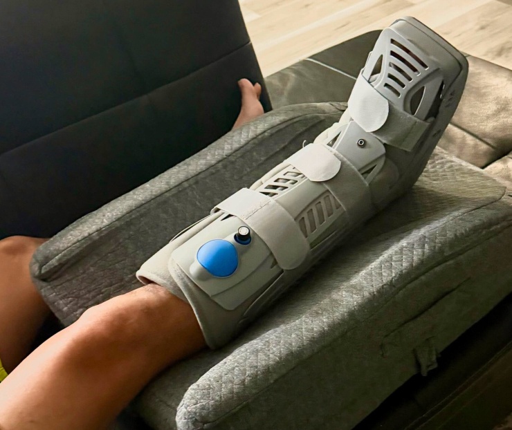 Mạnh Quỳnh bị chấn thương chân. Ảnh: FBNV