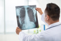 AI tìm ra nguyên tử bị ẩn mà tia X "bó tay"