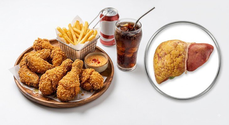 Chế độ ăn uống không lành mạnh là yếu tố nguy cơ cao gây tổn thương gan. Ảnh AI.