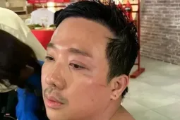 Trấn Thành chỉ ngủ 12 phút/ngày