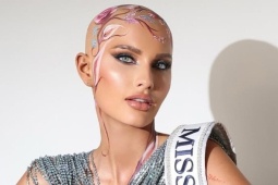 Hoa hậu Mỹ gây xúc động khi chia sẻ về chứng rụng tóc tại Miss World