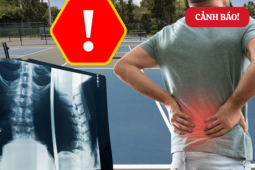 Tin tức sức khỏe - 4 môn thể thao người đau nhức xương khớp nên tránh, càng cố tập càng đau nặng hơn