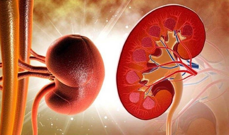 Viêm cầu thận cần nhận biết sớm để tránh biến chứng nguy hiểm. Ảnh AI.