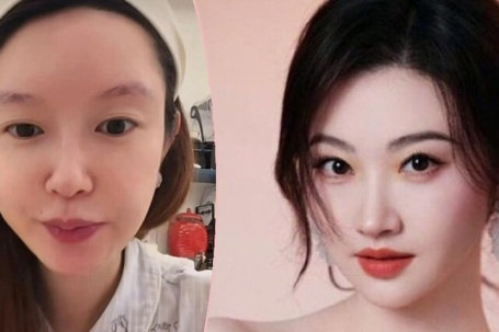 'Tiểu tam' Trương Đại Dịch chỉ trích Cảnh Điềm tham tiền, ảo tưởng