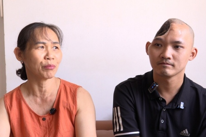 Hành trình 11 năm giành giật sự sống của chàng trai mất nửa hộp sọ