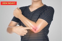 Tin tức sức khỏe - Dấu hiệu cảnh báo xương khớp đang bị tổn thương nghiêm trọng