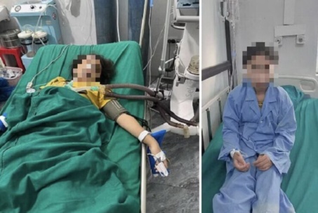 Cảnh báo khẩn sau vụ 2 mẹ con tử vong vì uống nước lá cây rừng