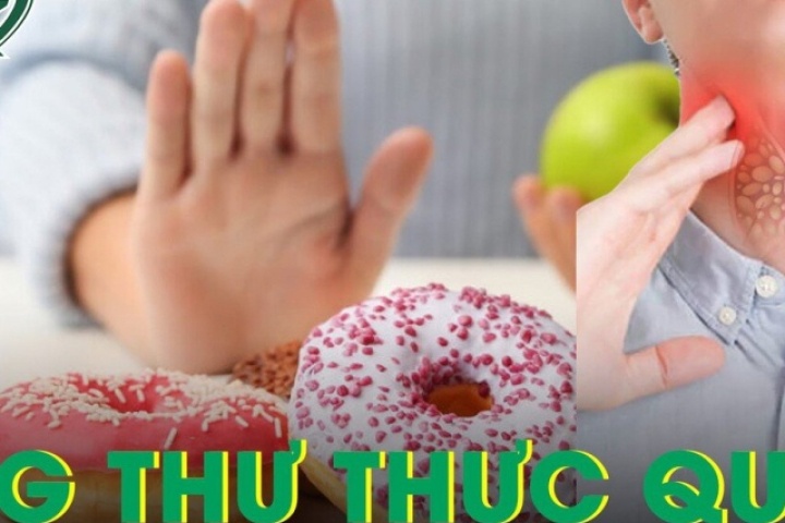 Người đàn ông ung thư thực quản bỏ đồ chế biến sẵn, nhận kết quả bất ngờ