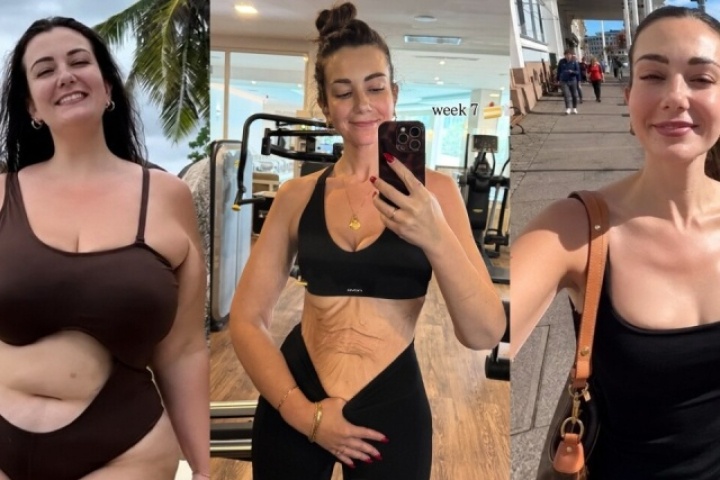 Người đẹp Anh giảm gần 80 kg để cải thiện sức khỏe