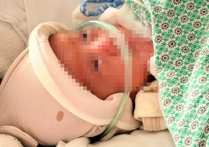 Kỳ tích cứu sống bé sinh non 750 gram, mắc bệnh phổi, nhiều lần ngừng thở