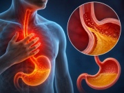 Trào ngược dạ dày thực quản gây hôi miệng phải làm gì?