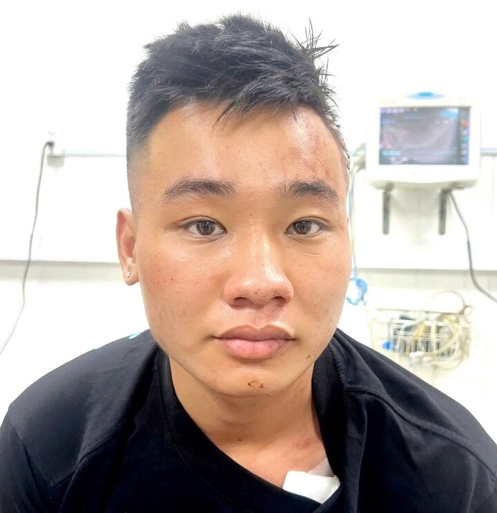 Đối tượng Nguyễn Đức Anh. (Ảnh: Công an TP Đồng Nai)