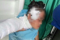 Người phụ nữ ở Nghệ An bị sét đánh trúng hiện sức khỏe giờ ra sao?