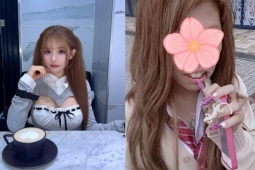 "Hot girl mạng" đổi đời nhờ phẫu thuật thẩm mỹ, bức ảnh trước đây gây sốc