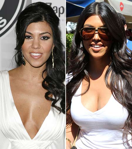 Bóc mẽ chuyện dao kéo của chị em Kardashian - 7