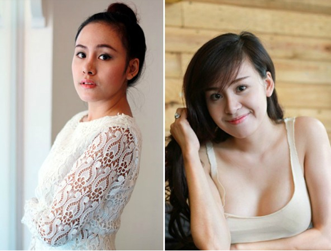 Tiến thân vào showbiz bằng con đường khoe thân nên Huyền Anh cũng không ít lần trùng tu nhan sắc.&nbsp;
