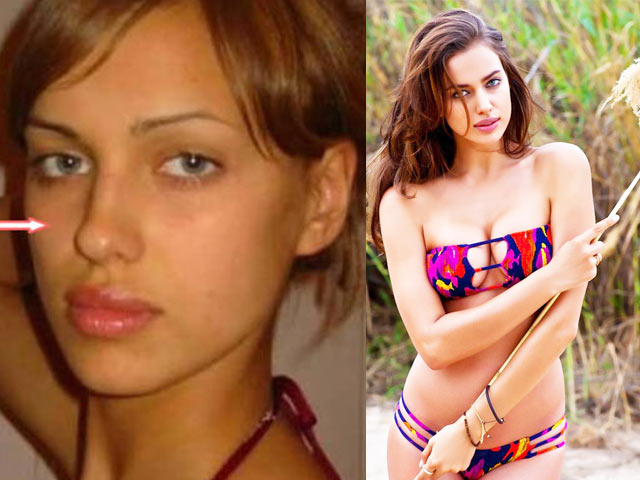 Khuôn mặt hoàn mỹ, khuôn ngực gợi cảm của Irina Shayk là tự nhiên hay nhân tạo?