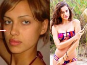 Thẩm mỹ viện - Khuôn mặt hoàn mỹ, khuôn ngực gợi cảm của Irina Shayk là tự nhiên hay nhân tạo?