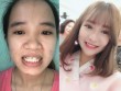 Xinh như mơ sau thẩm mỹ, cô gái Quảng Nam dám tỏ tình với "crush"