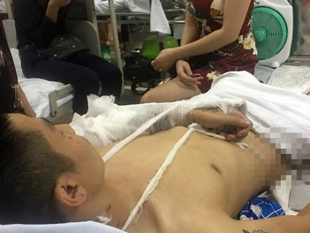 Pháp luật - Nam thanh niên kể lại giây phút bị nhóm đối tượng chém nát chân