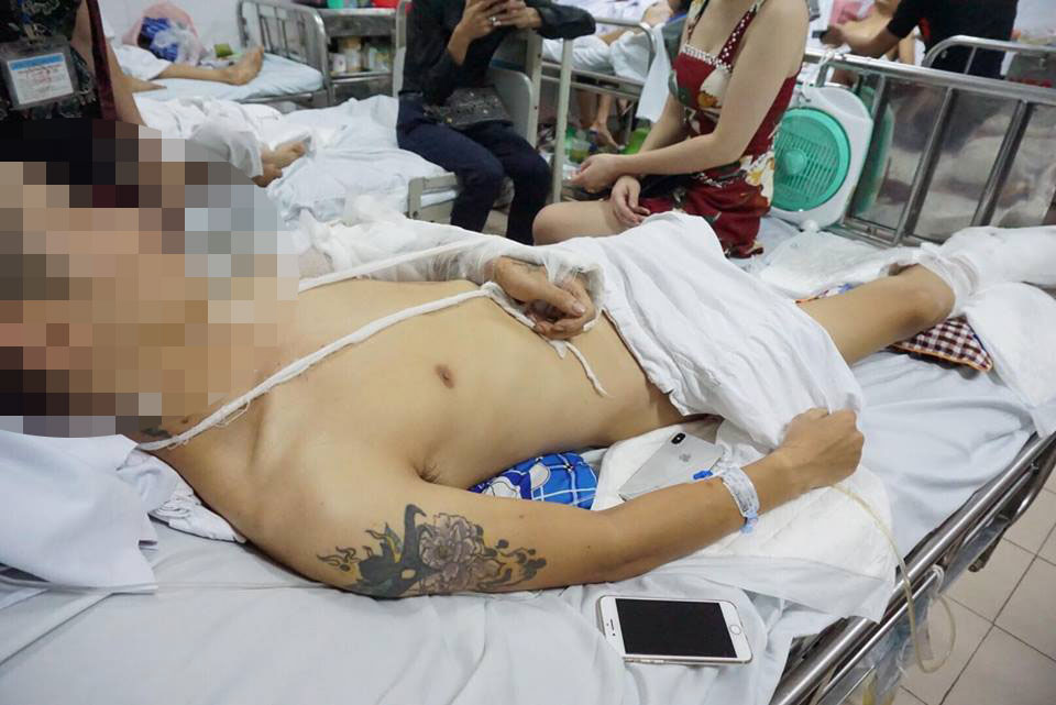 Vụ thanh niên bị chém dã man phải cưa chân: Hiện trường còn gì? - 1