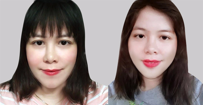 Cô giáo Bình Định có gương mặt méo lột xác ngoạn mục sau phẫu thuật - 4