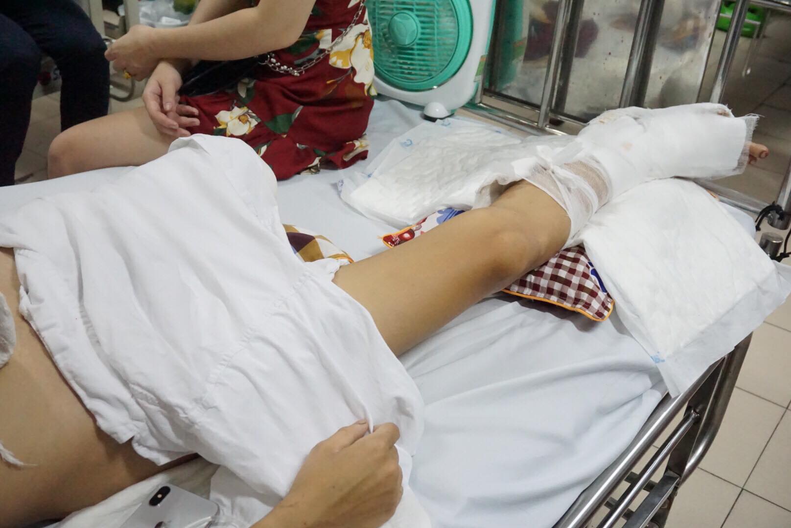 Vụ thanh niên bị chém phải cưa chân: Gây án có tổ chức sẽ đối mặt hình phạt nào? - 2