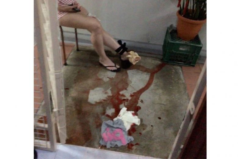 Singapore: Tưởng bị mèo cào, nhìn xuống hãi hùng thấy trăn tấn công - 1