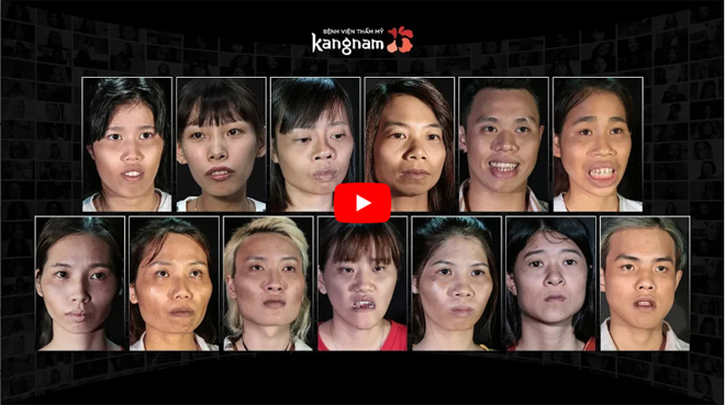 Lộ diện 13 thí sinh giành suất phẫu thuật thẩm mỹ miễn phí trị giá 500 triệu đồng - 6