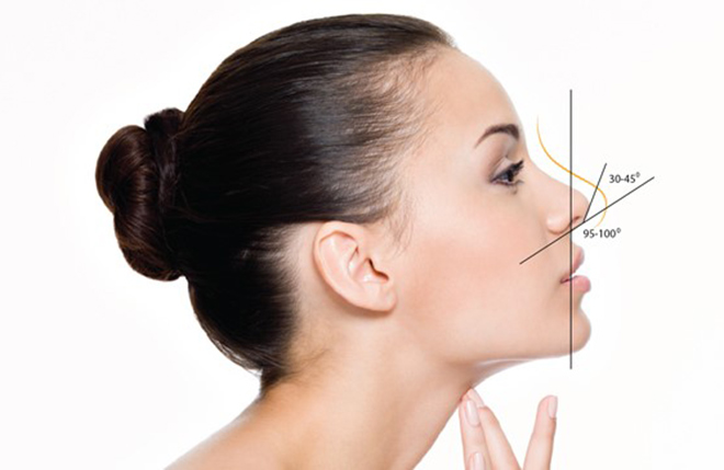 Bác sĩ 2CK1 Ngô Trọng Đức chia sẻ kỹ thuật nâng mũi tái cấu trúc và hiệu quả đạt được từ phương pháp này - 4