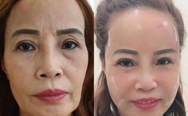 Chú rể 26 lấy vợ 62 tuổi chia sẻ bất ngờ về vợ chồng phẫu thuật thẩm mỹ - 3