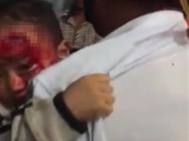 Tin tức trong ngày - Bệnh viện vắng tanh, cha ôm con máu chảy đầm đìa chờ bác sĩ